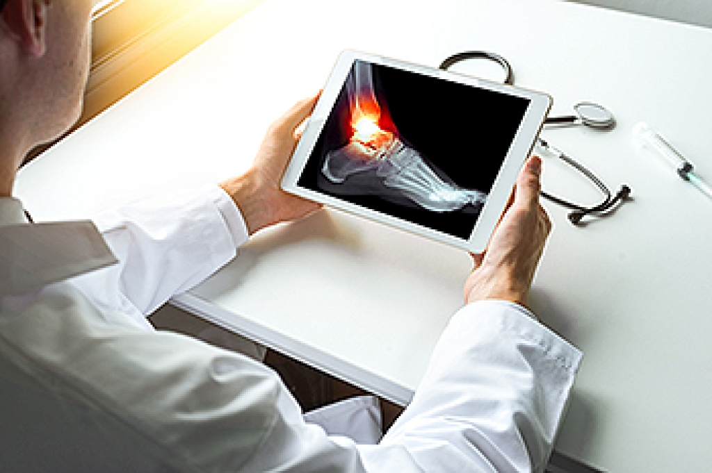Recognizing the Warning Signs of a Broken Ankle