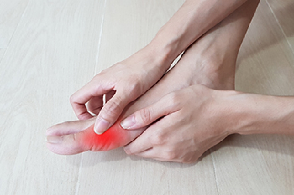 Podiatric Treatment for Gout